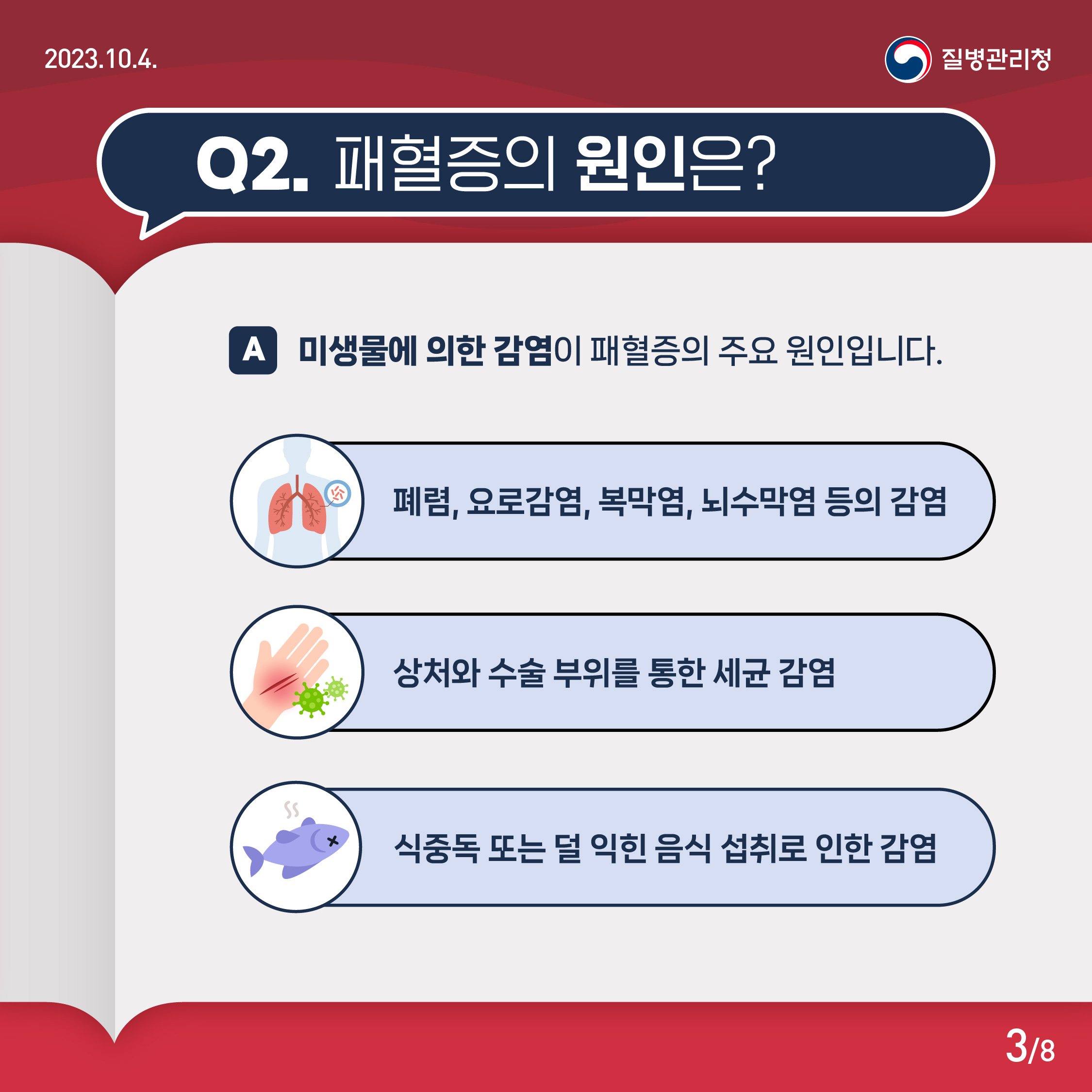 Q2. 패혈증의 원인은? A. 미생물에 의한 감염이 패혈증의 주요 원인입니다. 폐렴, 요로감염, 복막염, 뇌수막염 등의 감염 상처와 수술 부위를 통한 세균 감염 식중독 또는 덜 익힌 섭취로 인한 감염